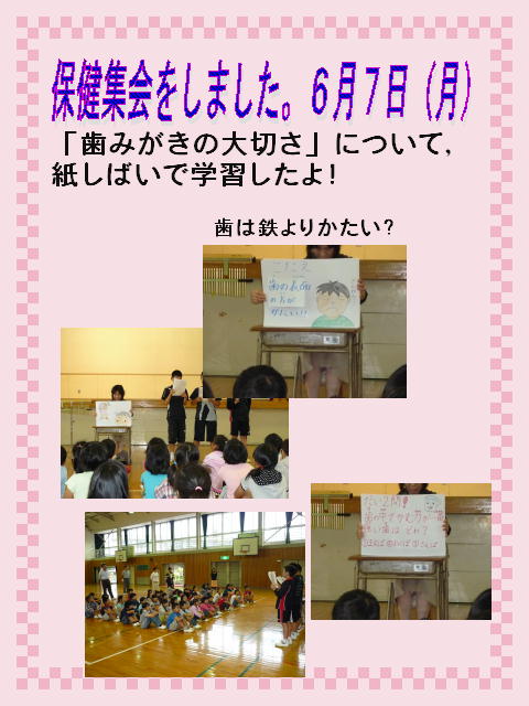 2y[W
